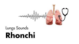 Rhonchi - Lung Sounds - Medzcool