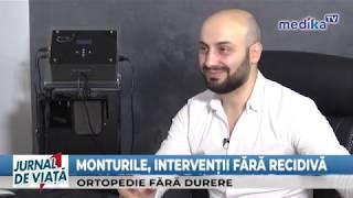 De ce apar monturi la picioare ne explica Dr Tarek Nazer