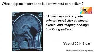 Wk 3-3 What is the role of cerebellum for consciousness?