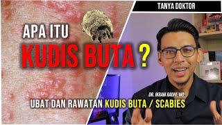 APA ITU KUDIS BUTA (SCABIES) ? Ubat dan Cara Merawat Kudis Buta