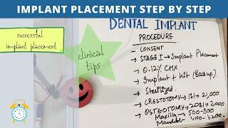 dental implant procedure