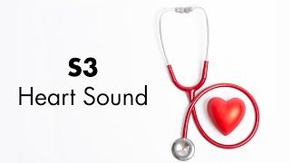 S3 Heart Sound - MEDZCOOL