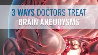 3 Ways Doctors Can Treat Your Brain Aneurysm