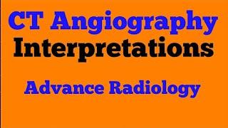 How to Do CT Angiography