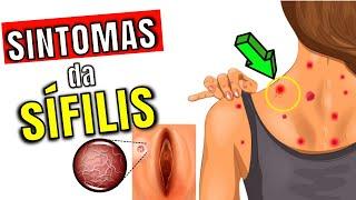 Sintomas da Sífilis: uma epidemia perigosa e SILENCIOSA