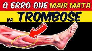 DON'T DIE FROM THROMBOSIS! | 7 PROVEN WAYS to IMPROVE CIRCULATION and PREVENT LEG CLOTS