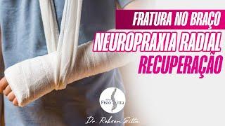 NEUROPRAXIA do NERVO RADIAL - FRATURA DIAFISÁRIA do ÚMERO RECUPERAÇÃO da CIRURGIA Dr. Robson Sitta