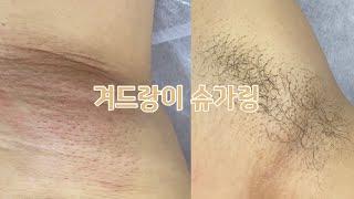 겨드랑이 푸쳐업 | 여름 겨드랑이어렵다..