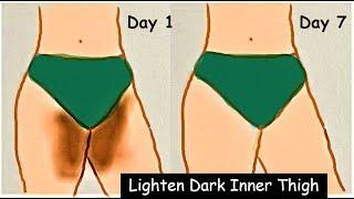 How i Lighten DARK Inner Thigh in 7 Days - Skin Lightening Dark Private Parts | Body Polishing Pack