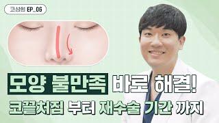 [위버스성형외과의원] 코끝처짐, 모양불만족 해결방법!