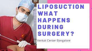 Liposuction- what happens during surgery? Venkat Center Bangalore. India Liposuction