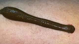 LEECH THERAPY | LEECH IN MEDICAL SCIENCE | Dr. PRAVEEN PATIL