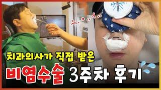 치과의사가 직접 받아본 비염수술 3주차 후기 | 비중격만곡증, 하비갑개절제술, 비밸브확장