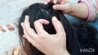 ASMR lice picking | lice picking ASMR #lice #liceremoval #licerelaxingvideo #licepicking