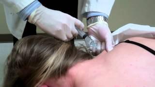 Trigger Point Injections for Pain and Headaches.