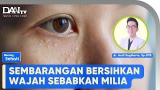 Tips Hilangkan Milia | Bincang Sehati