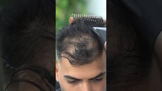 Hair Transformation by THICK FIBER #hairtransformation