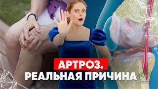 Как вылечить артроз без операции, уколов? Причины артроза