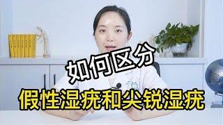 妇产科医生教你如何自查是假性湿疣还是尖锐湿疣