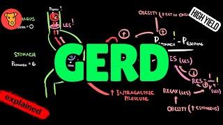 GASTROESOPHAGEAL REFLUX DISEASE Etiology Mechanism of the disease