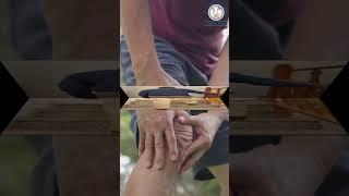 Dr Virendra | Knee Replacement Surgery
