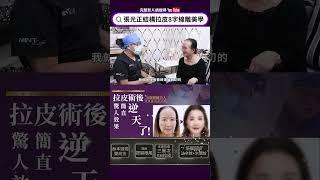 拉皮手術擠破頭都想找張帥！這回終於知道原因 70歲醫師夫人拉皮術後 驚人效果簡直逆天了！