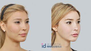 [Plastic surgery review] Jenna Talackova's interview before two-jaw surgery