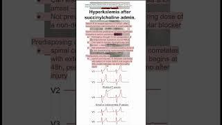 Hyperkalemia after succinylcholine admin.