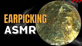 Earpicking ASMR : Professional Version