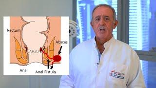 كيفية علاج الناسور الشرجي بالليزر خلال دقائق وبدون شق أو أي عمل جراحي - الدكتور عبد الغني دندن