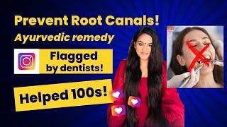 Prevent Root Canals with Ayurveda! | Simple Tip - Helped Hundreds, Flagged by Dentists!