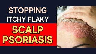 Scalp Psoriasis Explained: Surprising Skin Triggers + Better Treatments | Jenny Bennett