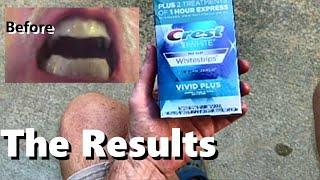 CREST Whitening Strips 3D *Before/After 12 Treatments -Vivid Plus Teeth Enamel Cleaning 30 minutes