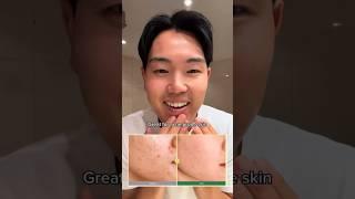 This toner has levelled up my skincare routine (tiktok: james.bok) #shorts #kbeauty #koreanskincare