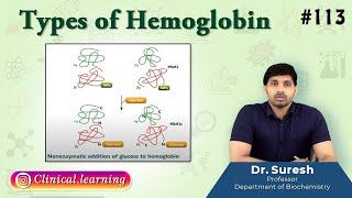 113. Types of Hemoglobin