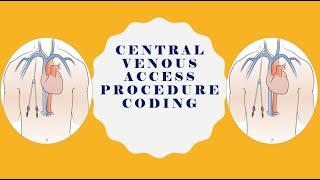 CARDIOVASCULAR SYSTEM CODING |CENTRAL VENOUS ACCESS PROCEDURES | MEDICLUX CODING TRAINING |