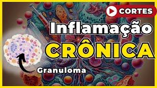 Inflamação Crônica [ Patologia Geral ]