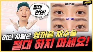 쌍꺼풀 재수술 모두 다 할 수 있다? 불가능한 사람 알려드립니다 - 닥터 성익현